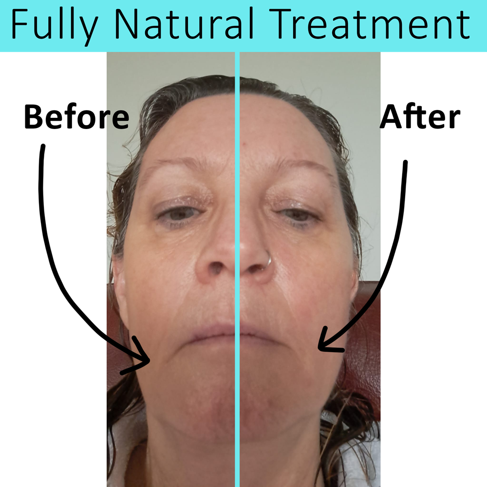 Before and After Treatment Results